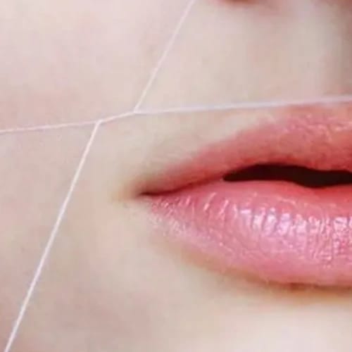 Upper lips